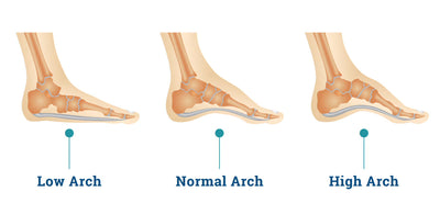 VKTRY Recommended By Prevention.com as Best Insoles for Arch Support