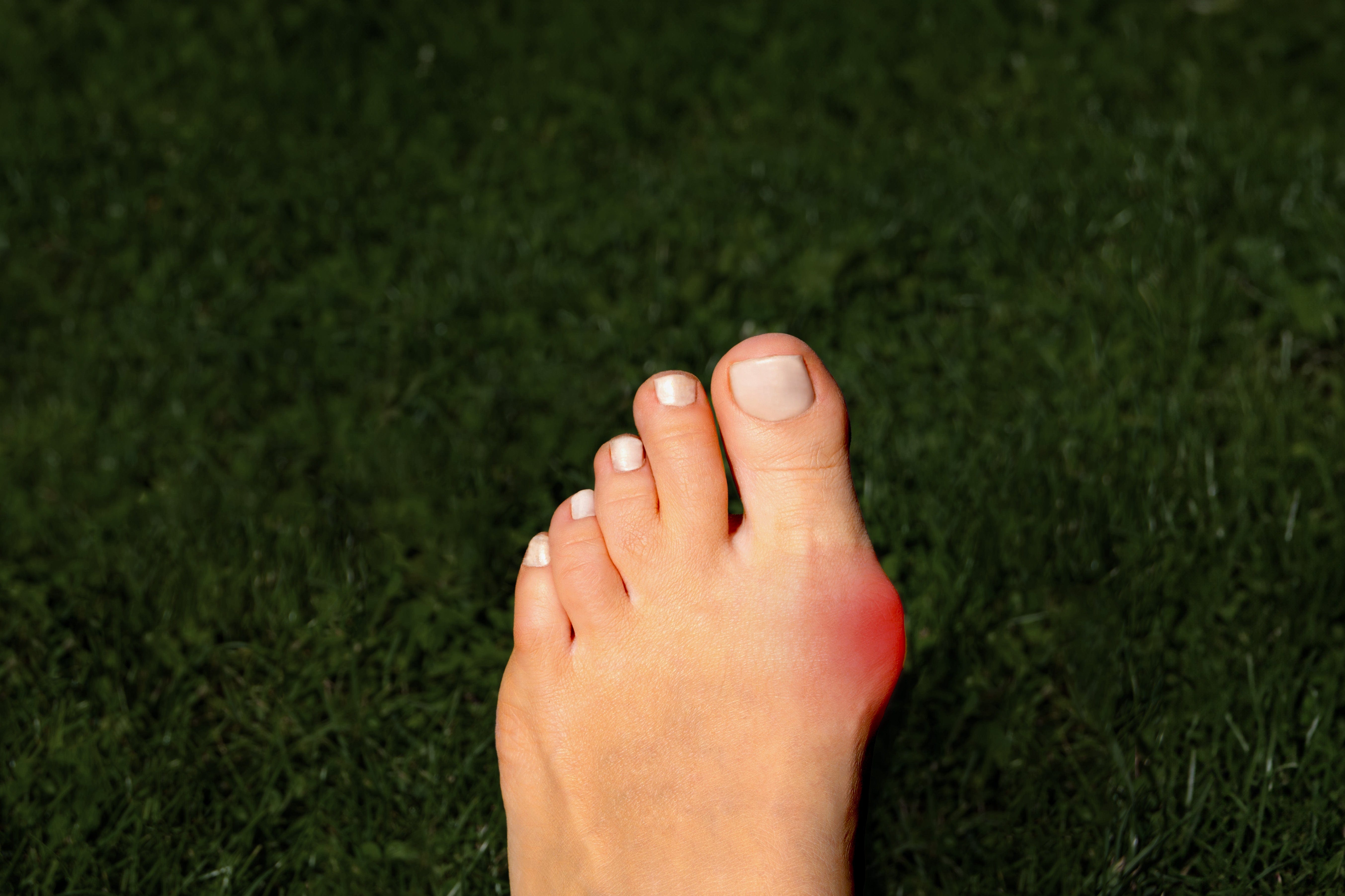Turf Toe – VKTRY